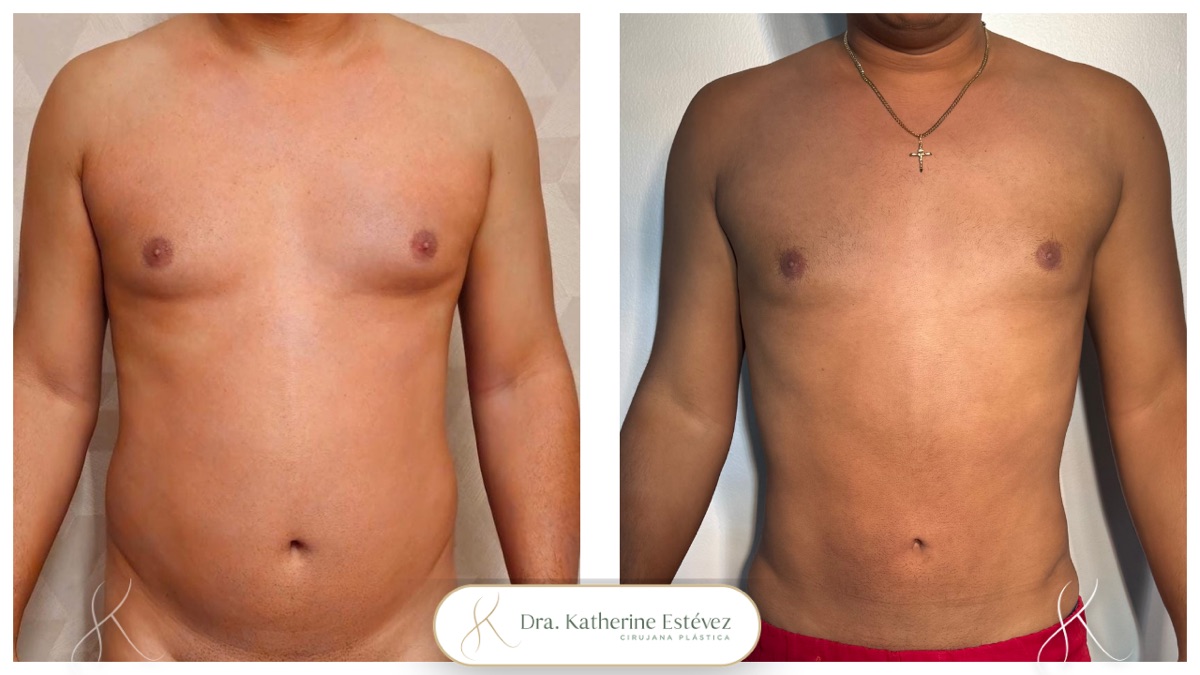 Lipo Atlética