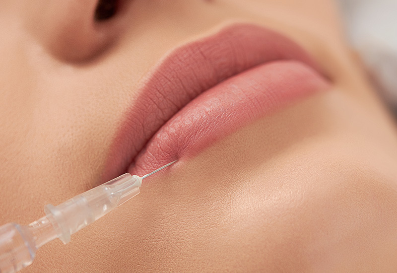 Perfilamiento y Aumento de Labios