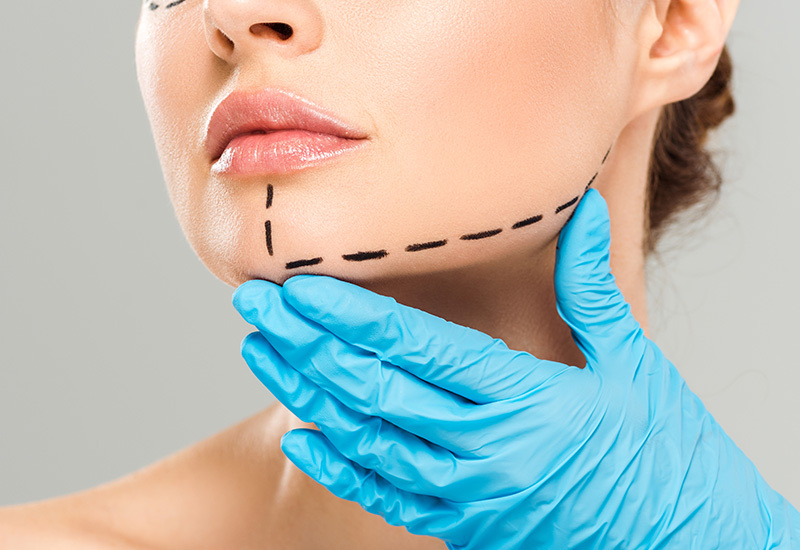 Implantes Faciales